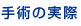 手術の実際:削除法
