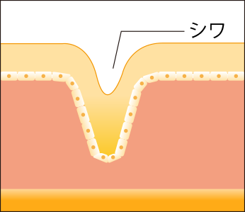 シワ