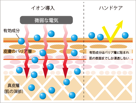 イオン導入