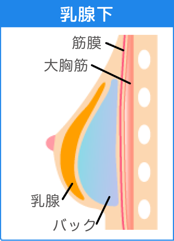 乳腺下