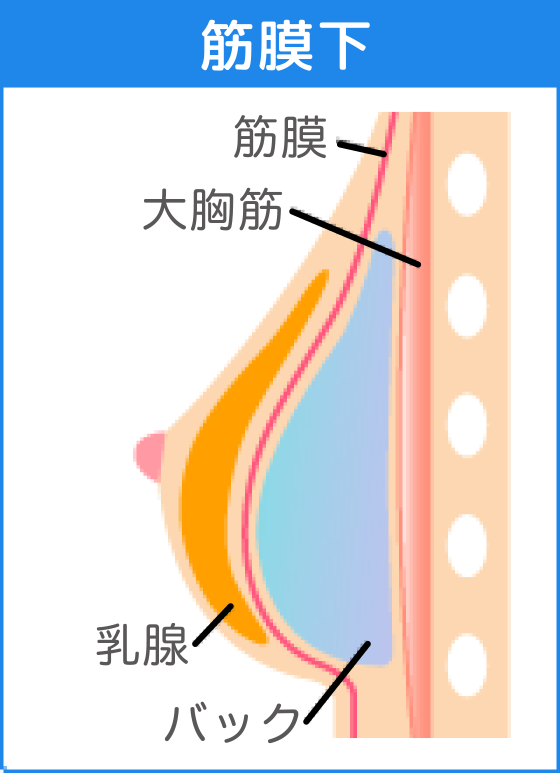 筋膜下