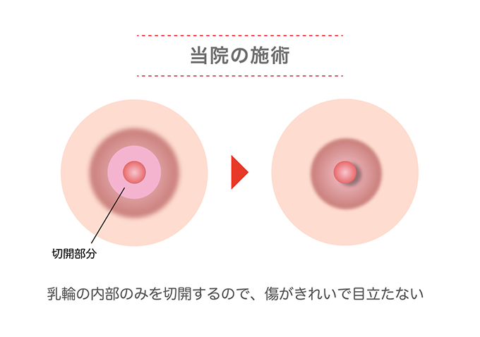 当院の施術