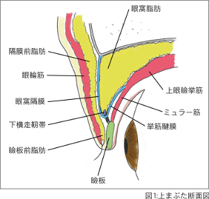 図1 上まぶたの断面図