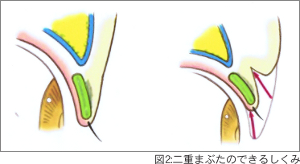 図2 二重まぶたができるしくみ