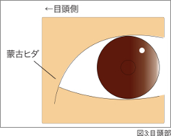 図3 目頭部