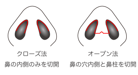 施術について