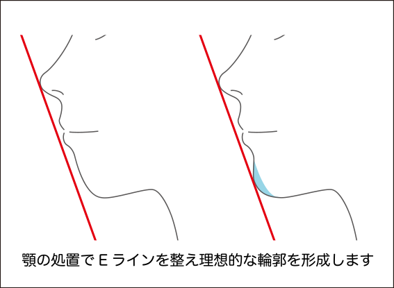 当院の医療脱毛